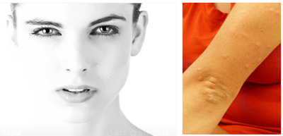 ��, �Ȳ�ġ.png